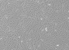 Human Adipose-Derived Mesenchymal Stem Cells HUXMD-01001
