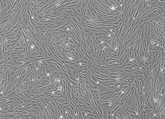 Rabbit Adipose-Derived Mesenchymal Stem Cells RBXMD-01001