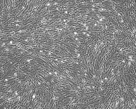 None Human Umbilical Cord Mesenchymal Stem Cells with GFP HUXUC-01101